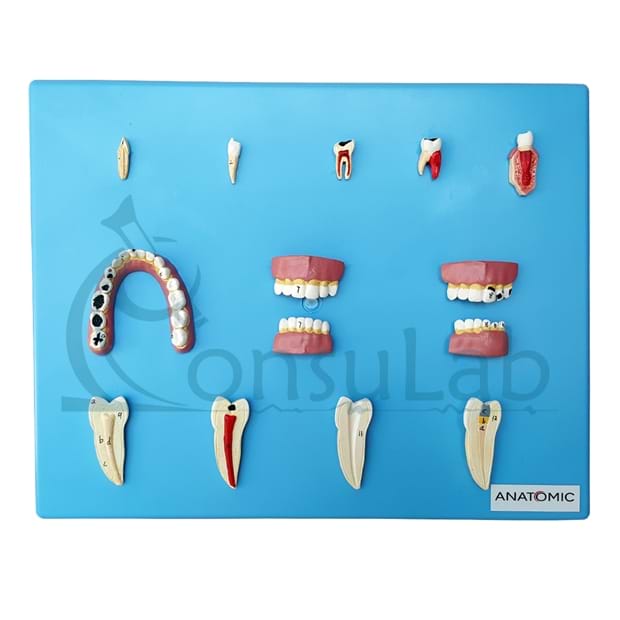 Patologia Dentária 12 Partes