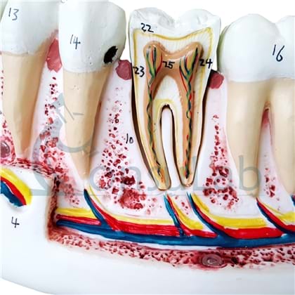 Anatomia dos Dentes  em 6 Partes