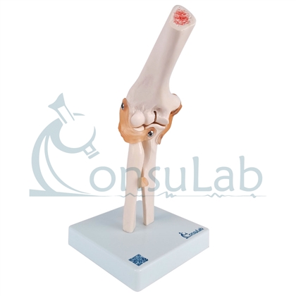 Modelo Anatômico de Articulação do Cotovelo com Ligamentos