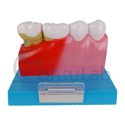 Patologia Dentária e Placa Explicativa em 2 Partes