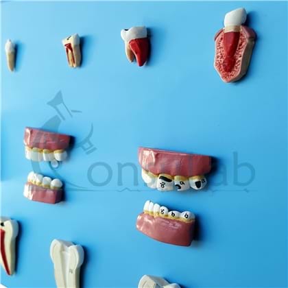 Patologia Dentária em 12 Partes