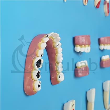 Patologia Dentária 12 Partes