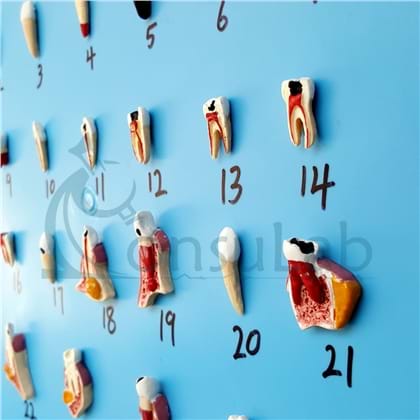 Patologia Dentária em 25 Partes